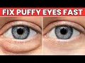 Download Lagu Puffy Eyes? One Kitchen Ingredient Fixes It Fast
