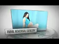 Tubal Reversal Surgery in Beverly Hills $2,499 - Dr. Aram Bonni