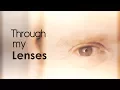 David Katz s inspirational story