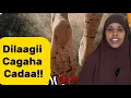 Download Lagu DILAAGII CAGAHA CADAA KIIS DHACAY 1929KII@SawdaBillan 
