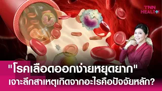 การวินิจฉัยและแนวทางการดูแลผู้ป่วยฮีโมฟิเลียเป็นอย่างไร