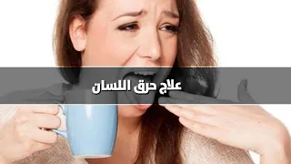 كيف تخفف من الم حرق اللسان 