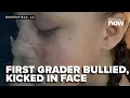 Bakersfield mom says first grader was kicked in face in bullying incident