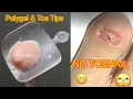 Polygel Toe Tips - Get a Toenail Easy