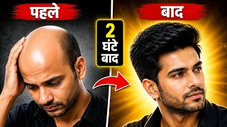 Best Hair Patches for Men and woman | Amazing Hair Wigs Transformation For Men thinextension