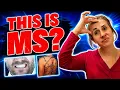 8 Rare MS Symptoms You ve Never Heard Of From a Nurse with MS