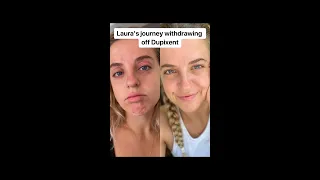 Laura s journey wit rawing off Dupixent