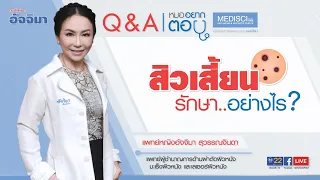 สิวเสี้ยนจมูกเกิดจากสาเหตุอะไรบ้าง