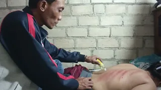 kerokan masuk angin wanita remaja sampai gosong sering begadang malam mbah maryono