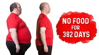 The Longest Fast in the World Dr Berg