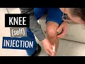 Knee Injection Steroid Technique Blind Anterolateral Approach