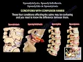 Spondylolysis Spondylolisthesis Spondylitis Spondylosis-Everything Need To Know-Dr Nabil Ebraheim