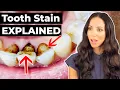 Dental Hygienist EXPLAINS Why Teeth Stain