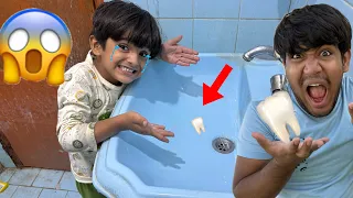 Pumpii ka dant toot gaya 😳 Ahmed ka Bhai bara hogya 😅 Pumpii Bichara dard huwa dant ka 🥺
