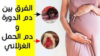 الفرق بين دم الدورة الشهرية و دم الحمل الغزلاني هكذا يمكنك أن ت مي زي بينهما 