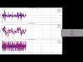 Optimization of Fuzzy-Fractional Controllers Using Genetic Algorithms-Inverted pendulum - Part 4