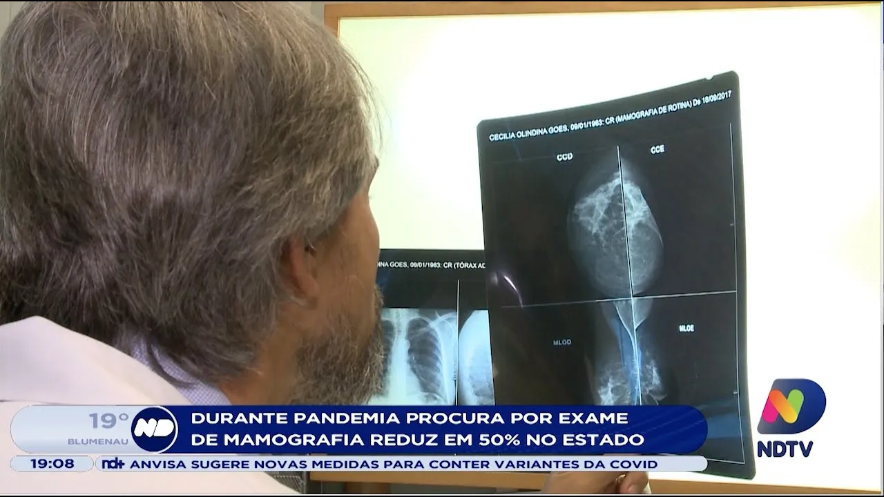 Durante pandemia procura por exame de mamografia reduz em 50% no Estado