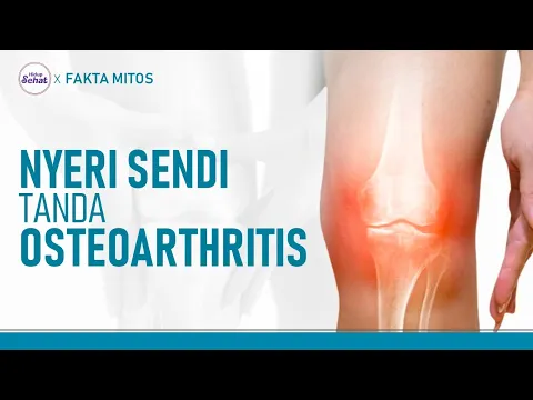 Gejala Osteoarthritis dan Cara Mengatasinya