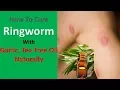 How To Cure Ringworm With Garlic Tea Tree Oil Naturally