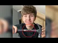 I broke my finger Behind the scenes