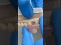 Lateral Nesbit EnvisiontecMain
