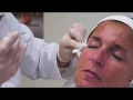 Botox - Medecin Esthetique a Lyon