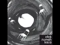 Sebelah Mata
