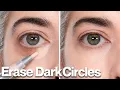 Dark Circles Disappear With This One Technique