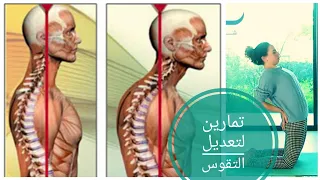 حل لتقوس الظهر في 3 اسابيع شدانا يوغا 