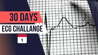 Download Day 1: Know Your Expertise in ECG Interpretation | 30-Day ECG challenge MP3