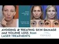 How Skin Damage and Volume Loss from Treatments are Avoided and Treated