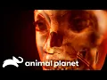 Download Lagu What Could Be Growing in This Woman's Nose?! | Monsters Inside Me | Animal Planet