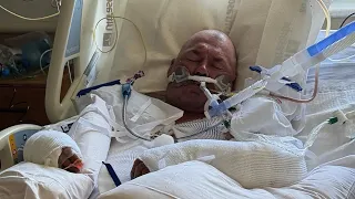 Taft police investigate man allegedly set on fire