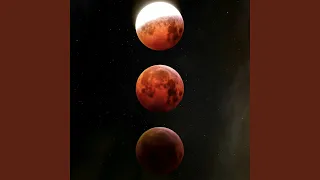 موند  آکوستیک  دندنها