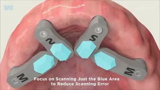 Introducing TruAbutment s Latest Innovation ioConnect
