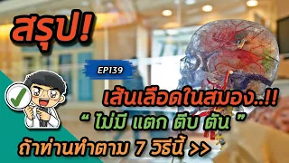  ทำไมการทานยาตามแพทย์สั่งจึงสำคัญสำหรับผู้ที่มีเส้นเลือดในสมองเสี่ยงแตก 