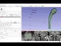 Quick manual segmentation with contour interpolation