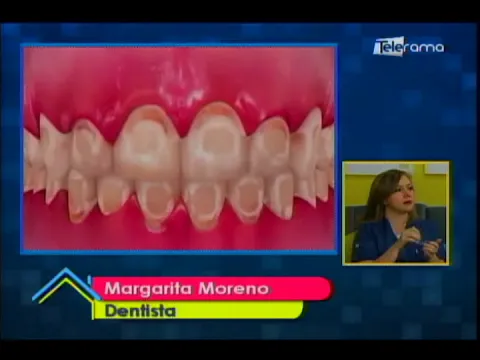 ¿Cuándo es necesario usar brackets?