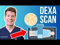 Doctor explains Bone Density Scan DEXA DXA scan