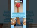 Download Lagu TFCC INJURY | Learn More | Chiropractic \u0026 Sports Physiotherapy | Synchrony