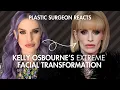 Kelly Osbourne Weight Loss Plastic Surgeon Reacts to Facial Transformation
