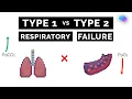 Type 1 vs Type 2 Respiratory Failure ABG Interpretation UKMLA CPSA PLAB 2
