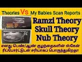 Ramzi, Skull, Nub Theories Vs My Girl/Boy Babies scan Reports|எனது குழந்தைகளின் ஸ்கேன் ரிப்போர்ட்