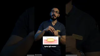 هل لازم نستئصل الكيس الدهني 
