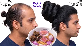 💯 Onion And Fenugreek Seeds For 30x Rapid Thick Black Hair Growth💥 Faster Silky Smooth Hair🤩