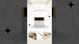 كريم التين الشوكي الحل النهائي للتجاعيد 