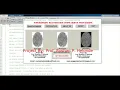 Fingerprint Recognition Using Image Processing Matlab Project With Source Code Fingerprint Analysi