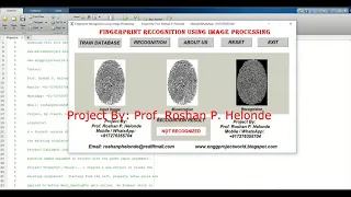 Fingerprint Recognition Using Image Processing Matlab Project With Source Code Fingerprint Analysi