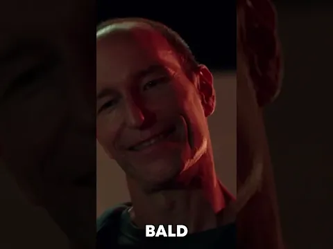 Average bald man experience