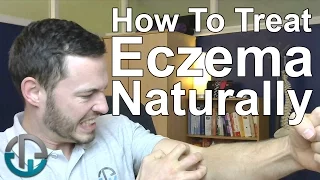 Download How To Treat Eczema Naturally MP3